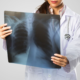 什麼是肺癌的分期？了解肺癌期數及其存活率
